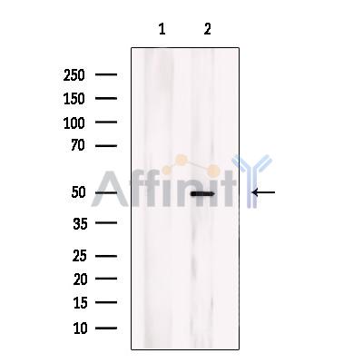 CHST1 Antibody - Western blot analysis of extracts from K562 cells, using CHST1 Antibody.