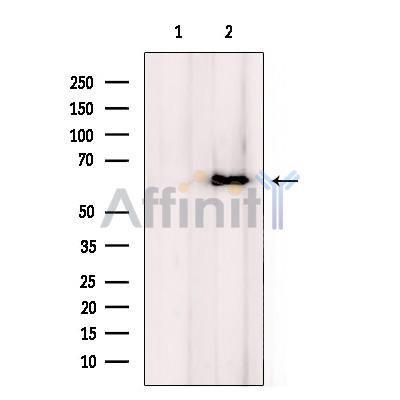 CPN2 Antibody - Western blot analysis of extracts from HeLa cells, using CPN2 Antibody.