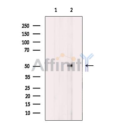 HUCE1 Antibody - Western blot analysis of extracts from MCF-7 cells, using HUCE1 Antibody.