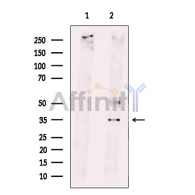 RNF144B Antibody - Western blot analysis of extracts from HeLa cells, using RNF144B Antibody.