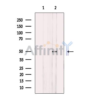 KCNN4 Antibody - Western blot analysis of extracts from HepG2 cells, using KCNN4 Antibody.