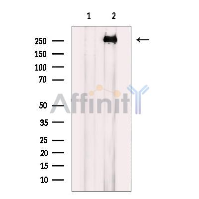 MEGF8 Antibody - Western blot analysis of extracts from COLO cells, using MEGF8 Antibody.