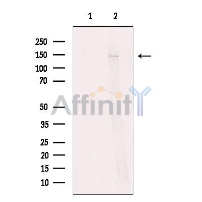 NCAN Antibody - Western blot analysis of extracts from Jurkat cells, using NCAN Antibody.