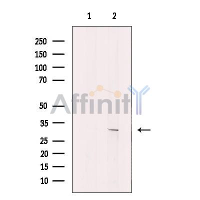 KCNK7 Antibody - Western blot analysis of extracts from Jurkat cells, using KCNK7 Antibody.