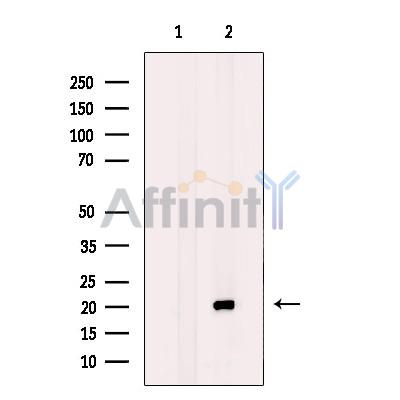 BTC Antibody - Western blot analysis of extracts from PC3 cells, using BTC Antibody.