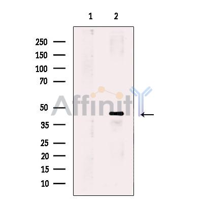 PPM1L Antibody - Western blot analysis of extracts from Jurkat cells, using PPM1L Antibody.