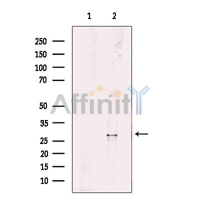 RAB26 Antibody - Western blot analysis of extracts from mouse brain tissue, using RAB26 Antibody.