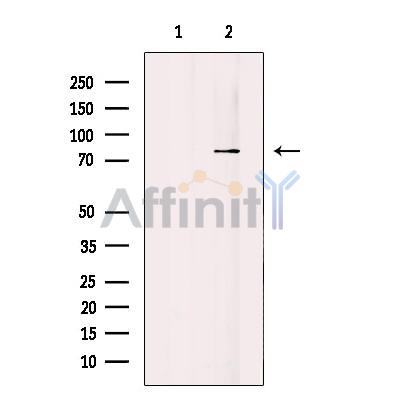 ARHGEF16 Antibody - Western blot analysis of extracts from A549 cells, using ARHGEF16 Antibody.