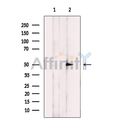 NIM1 Antibody - Western blot analysis of extracts from HepG2 cells, using NIM1 Antibody.