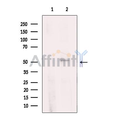 PPP4R1L Antibody - Western blot analysis of extracts from HepG2 cells, using PPP4R1L Antibody.