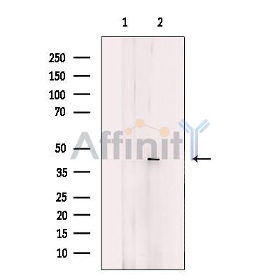 GTF3A Antibody - Western blot analysis of extracts from Jurkat cells, using GTF3A Antibody.