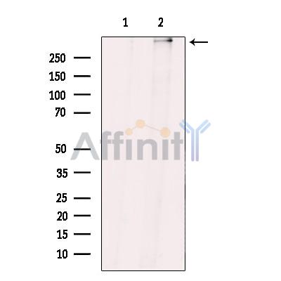 ZNF292 Antibody - Western blot analysis of extracts from HuvEc cells, using ZNF292 Antibody.
