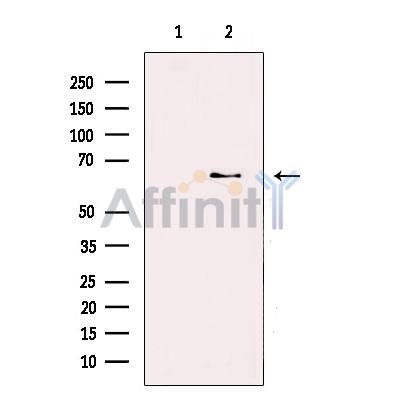 ZNF695 Antibody - Western blot analysis of extracts from Jurkat cells, using ZNF695 Antibody.