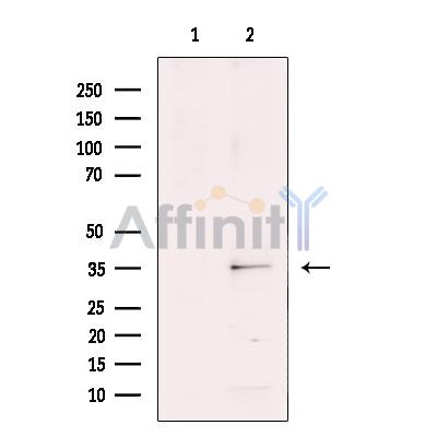 RNF113B Antibody - Western blot analysis of extracts from COLO205 cells, using RNF113B Antibody.