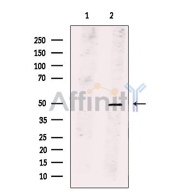 PLAGL1 Antibody - Western blot analysis of extracts from 293 cells, using PLAGL1 Antibody.