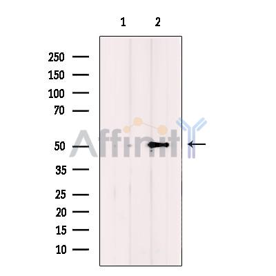 IFIT5 Antibody - Western blot analysis of extracts from Jurkat cells, using IFIT5 Antibody.