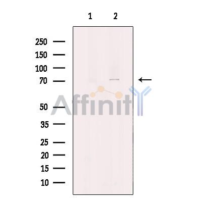 CHFR Antibody - Western blot analysis of extracts from Jurkat cells, using CHFR Antibody.