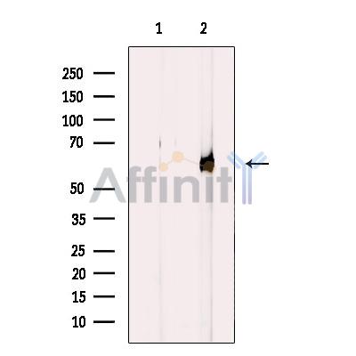 Cytochrome P450 4V2 Antibody - Western blot analysis of extracts from Jurkat cells, using Cytochrome P450 4V2 Antibody.