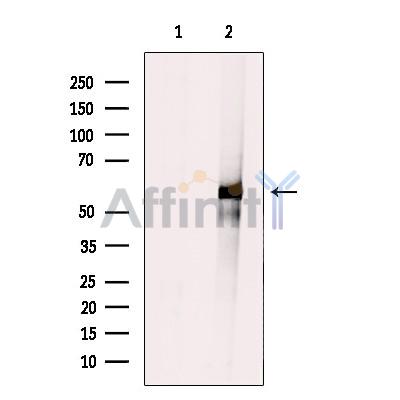 Cytochrome P450 2A7 Antibody - Western blot analysis of extracts from K562 cells, using Cytochrome P450 2A7.