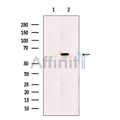 STK33 Antibody - Western blot analysis of extracts from HeLa cells, using STK33 Antibody.