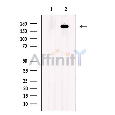 LY75 Antibody - Western blot analysis of extracts from COLO205 cells, using LY75 Antibody.