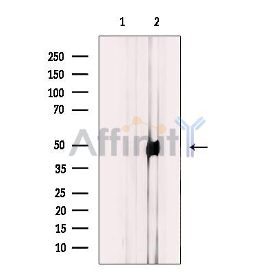 GPRC5B Antibody - Western blot analysis of extracts from HUVEC, using GPRC5B Antibody.