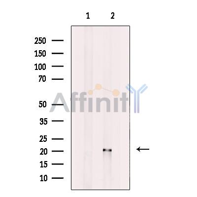 ATF3 Antibody - Western blot analysis of extracts from mouse brain tissue, using ATF3 Antibody.
