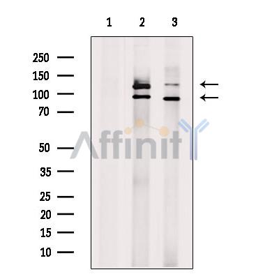 PARP1 Antibody - Western blot analysis of extracts from various samples, using PARP1 Antibody.