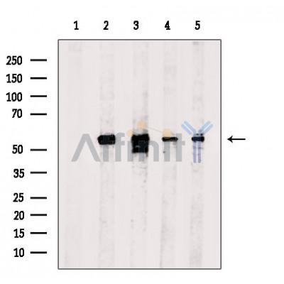 DLD Antibody - Western blot analysis of extracts from various samples, using DLD Antibody.