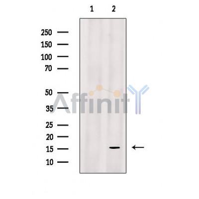Substance P Antibody - Western blot analysis of extracts from mouse spleen tissue, using Substance P Antibody.
