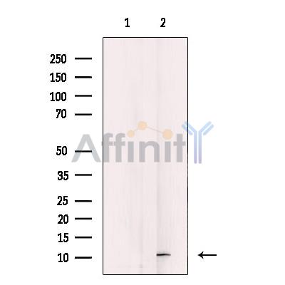 DAP Antibody - Western blot analysis of extracts from COLO205, using DAP Antibody.