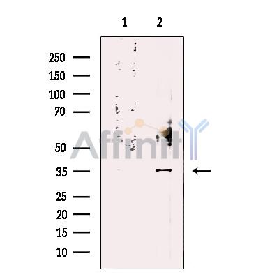 PP2A-C alpha/beta Antibody - Western blot analysis of extracts from MCF7, using PP2A-C alpha/beta Antibody.