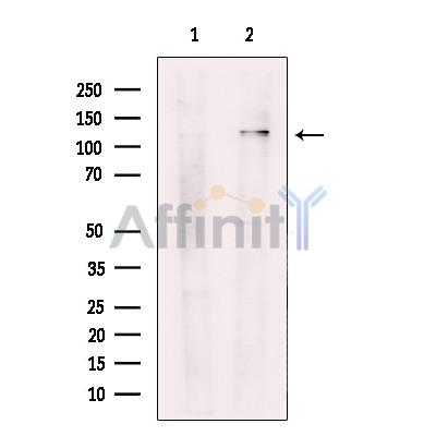 CAMTA2 Antibody - Western blot analysis of extracts from Mouse brain, using CAMTA2 Antibody.