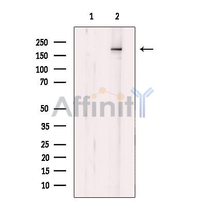 MIA3 Antibody - Western blot analysis of extracts from Jurkat, using MIA3 Antibody.