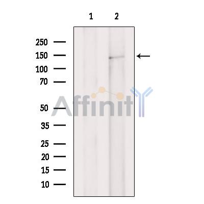 ULK4 Antibody - Western blot analysis of extracts from HepG2 cells, using ULK4 Antibody.