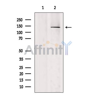 SH3TC2 Antibody - Western blot analysis of extracts from Mouse  brain, using SH3TC2 Antibody.