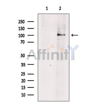 TBC1D2 Antibody - Western blot analysis of extracts from C6 cells, using TBC1D2 Antibody.