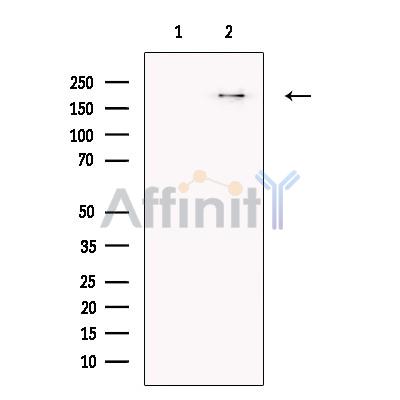 COL18A1 Antibody - Western blot analysis of extracts from Mouse  Liver, using Collagen XVIIIalpha 1 Antibody.