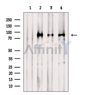 Phospho-STAT1 (Ser727) Antibody - Western blot analysis of extracts from various samples, using Phospho-STAT1 (Ser727) Antibody.