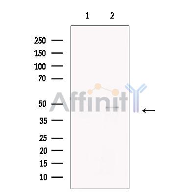 Cleaved-Caspase 9 (Asp353) Antibody - Western blot analysis of extracts from A549, using Caspase 9 (Cleaved-Asp353) Antibody.