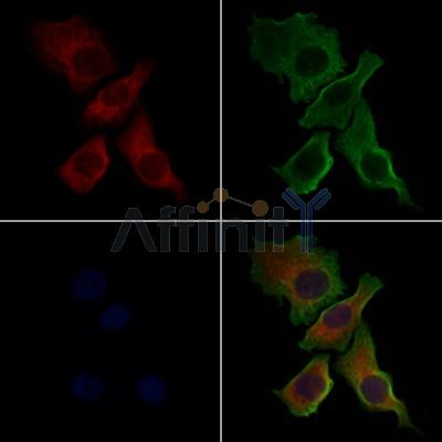 CXCR4 Antibody - AF5279 staining Hela cells by IF/ICC.