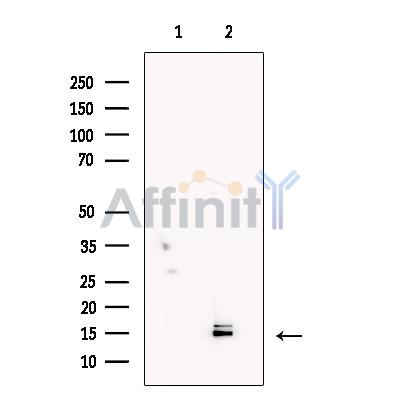 LC3A/B Antibody - Western blot analysis of extracts from PC12(LPS treatment), using lc3 A/B Antibody.