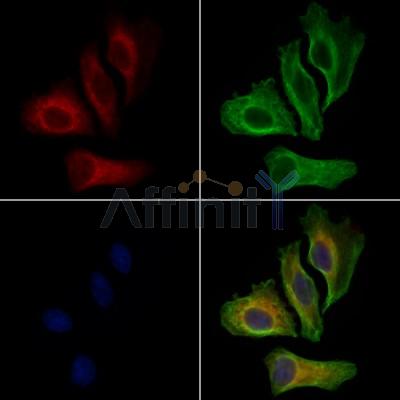 EGFR Antibody - AF6043 staining Hela cells by IF/ICC.