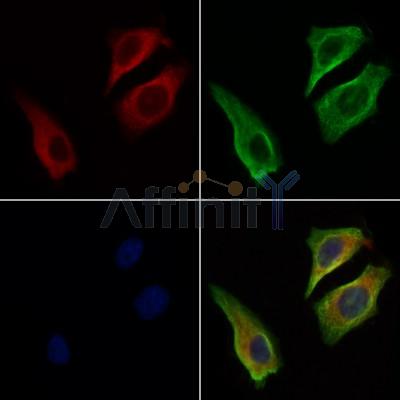 ZAP70 Antibody - AF6312 staining Hela cells by IF/ICC.