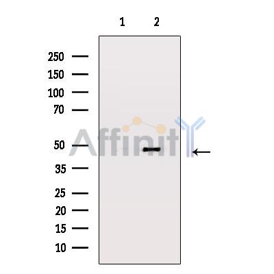 MEK4/MKK4 Antibody - Western blot analysis of SEK1/MKK4 expression in Hela whole cell lysates.