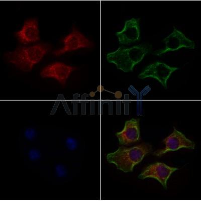 TRAF7 Antibody - AF7546 staining HepG2 cells by IF/ICC.