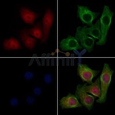 Gli3 Antibody - AF7949 staining Hela cells by IF/ICC.