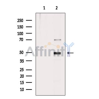 Arrdc1 Antibody - Western blot analysis of extracts from Hela cells, using Arrdc1 Antibody.