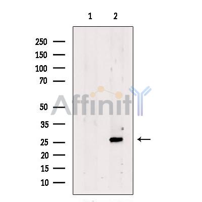SCAND1 Antibody - Western blot analysis of extracts from Rat  kidney, using SCAND1 Antibody.