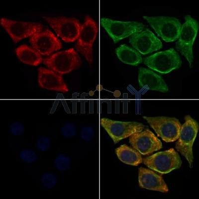 CCR3 Antibody - DF10205 staining HepG2 cells by IF/ICC.